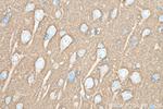 SNAP25 Antibody in Immunohistochemistry (Paraffin) (IHC (P))