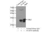 SNAP25 Antibody in Immunoprecipitation (IP)