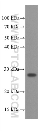 SNAP25 Antibody in Western Blot (WB)