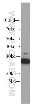 SNAP25 Antibody in Western Blot (WB)