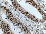 MSH2 Antibody in Immunohistochemistry (Paraffin) (IHC (P))