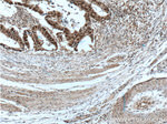 MSH2 Antibody in Immunohistochemistry (Paraffin) (IHC (P))