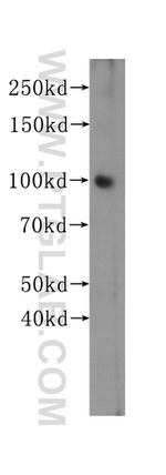 MSH2 Antibody in Western Blot (WB)