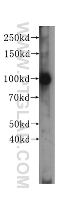 MSH2 Antibody in Western Blot (WB)