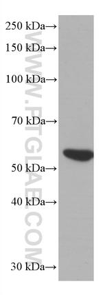 LCK Antibody in Western Blot (WB)