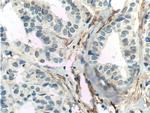 TEM1 Antibody in Immunohistochemistry (Paraffin) (IHC (P))