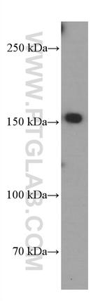 TEM1 Antibody in Western Blot (WB)