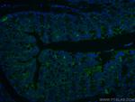 ALDH1A1 Antibody in Immunohistochemistry (PFA fixed) (IHC (PFA))