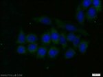 ALDH1A1 Antibody in Immunocytochemistry (ICC/IF)