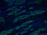 ACPP Antibody in Immunohistochemistry (PFA fixed) (IHC (PFA))