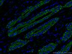 ACPP Antibody in Immunohistochemistry (PFA fixed) (IHC (PFA))