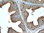 ACPP Antibody in Immunohistochemistry (Paraffin) (IHC (P))