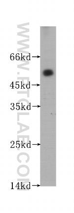 ACPP Antibody in Western Blot (WB)