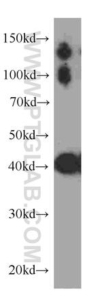 CKM Antibody in Western Blot (WB)