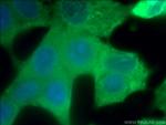 BCL2 Antibody in Immunocytochemistry (ICC/IF)