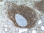 BCL2 Antibody in Immunohistochemistry (Paraffin) (IHC (P))