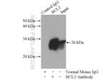 BCL2 Antibody in Immunoprecipitation (IP)