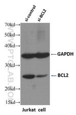 BCL2 Antibody in Western Blot (WB)