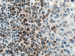 BCL2 Antibody in Immunohistochemistry (Paraffin) (IHC (P))