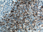 BCL2 Antibody in Immunohistochemistry (Paraffin) (IHC (P))