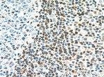 BCL2 Antibody in Immunohistochemistry (Paraffin) (IHC (P))