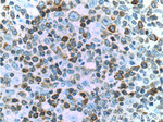 BCL2 Antibody in Immunohistochemistry (Paraffin) (IHC (P))