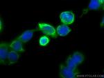 Cytokeratin 20 Antibody in Immunocytochemistry (ICC/IF)