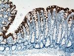 Cytokeratin 20 Antibody in Immunohistochemistry (Paraffin) (IHC (P))