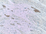 Cytokeratin 20 Antibody in Immunohistochemistry (Paraffin) (IHC (P))