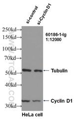 Cyclin D1 Antibody in Western Blot (WB)