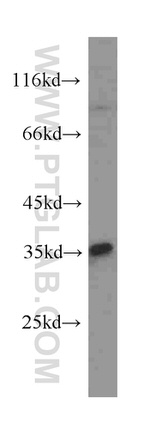 Cyclin D1 Antibody in Western Blot (WB)