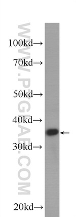 Cyclin D1 Antibody in Western Blot (WB)