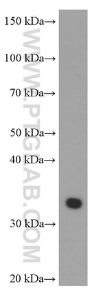 Cyclin D1 Antibody in Western Blot (WB)