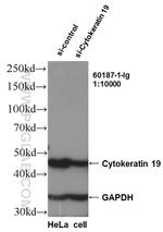 Cytokeratin 19 Antibody in Western Blot (WB)