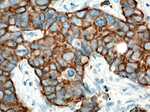 Cytokeratin 19 Antibody in Immunohistochemistry (Paraffin) (IHC (P))