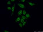 WTAP Antibody in Immunocytochemistry (ICC/IF)