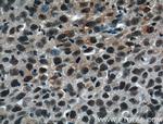 WTAP Antibody in Immunohistochemistry (Paraffin) (IHC (P))