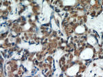 WTAP Antibody in Immunohistochemistry (Paraffin) (IHC (P))