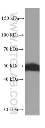 WTAP Antibody in Western Blot (WB)