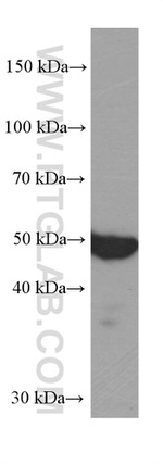 WTAP Antibody in Western Blot (WB)