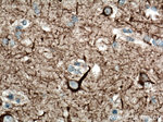 NF-L Antibody in Immunohistochemistry (Paraffin) (IHC (P))