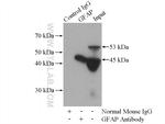 GFAP Antibody in Immunoprecipitation (IP)