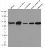 GFAP Antibody in Western Blot (WB)