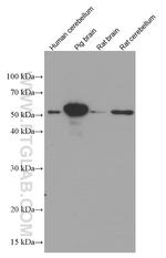 GFAP Antibody in Western Blot (WB)