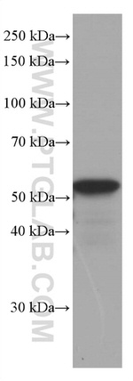 GFAP Antibody in Western Blot (WB)