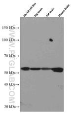 TNFR1 Antibody in Western Blot (WB)