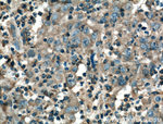 TNFR1 Antibody in Immunohistochemistry (Paraffin) (IHC (P))