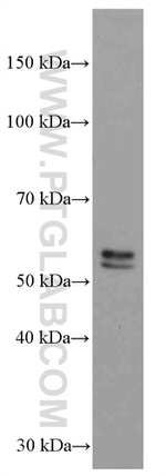 TNFR1 Antibody in Western Blot (WB)