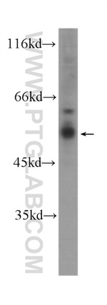 TNFR1 Antibody in Western Blot (WB)