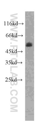 PPARD Antibody in Western Blot (WB)